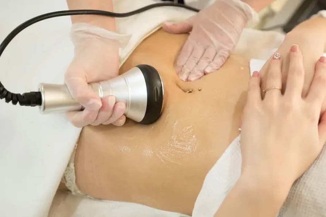 دستگاه لاغری کویتیشن: لاغری موضعی و بدون جراحی دستگاه کویتیشن در کلینیک سرو بوشهر